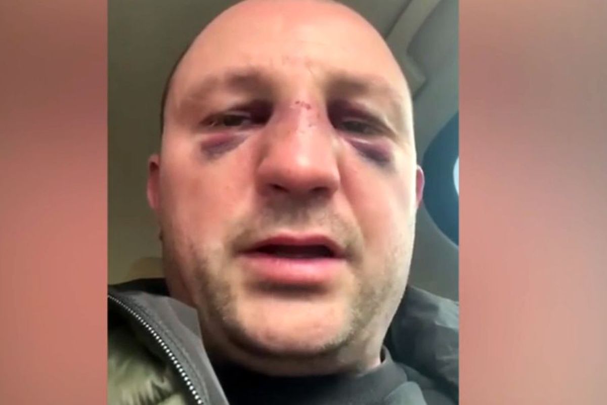VIDEO EXCLUSIV Fost kickboxer român, snopit în bătaie în plină stradă de un fost pugilist: „A încercat să mă înjunghie!”