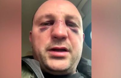 VIDEO EXCLUSIV Fost kickboxer român, snopit în bătaie în plină stradă de un fost pugilist: „A încercat să mă înjunghie!”