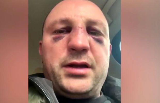 VIDEO EXCLUSIV Fost kickboxer român, snopit în bătaie în plină stradă de un fost pugilist: „A încercat să mă înjunghie!”
