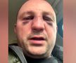 Fostul kickboxer Mihai Oprea a fost bătut de Vitalie Bîrza în plină stradă