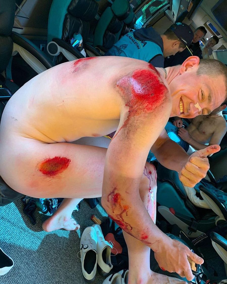 Imagini sensibile la o cursă din Franța » Un ciclist rus a suferit o accidentare teribilă! Plin de sânge pe coate, genunchi, umăr și coapsă