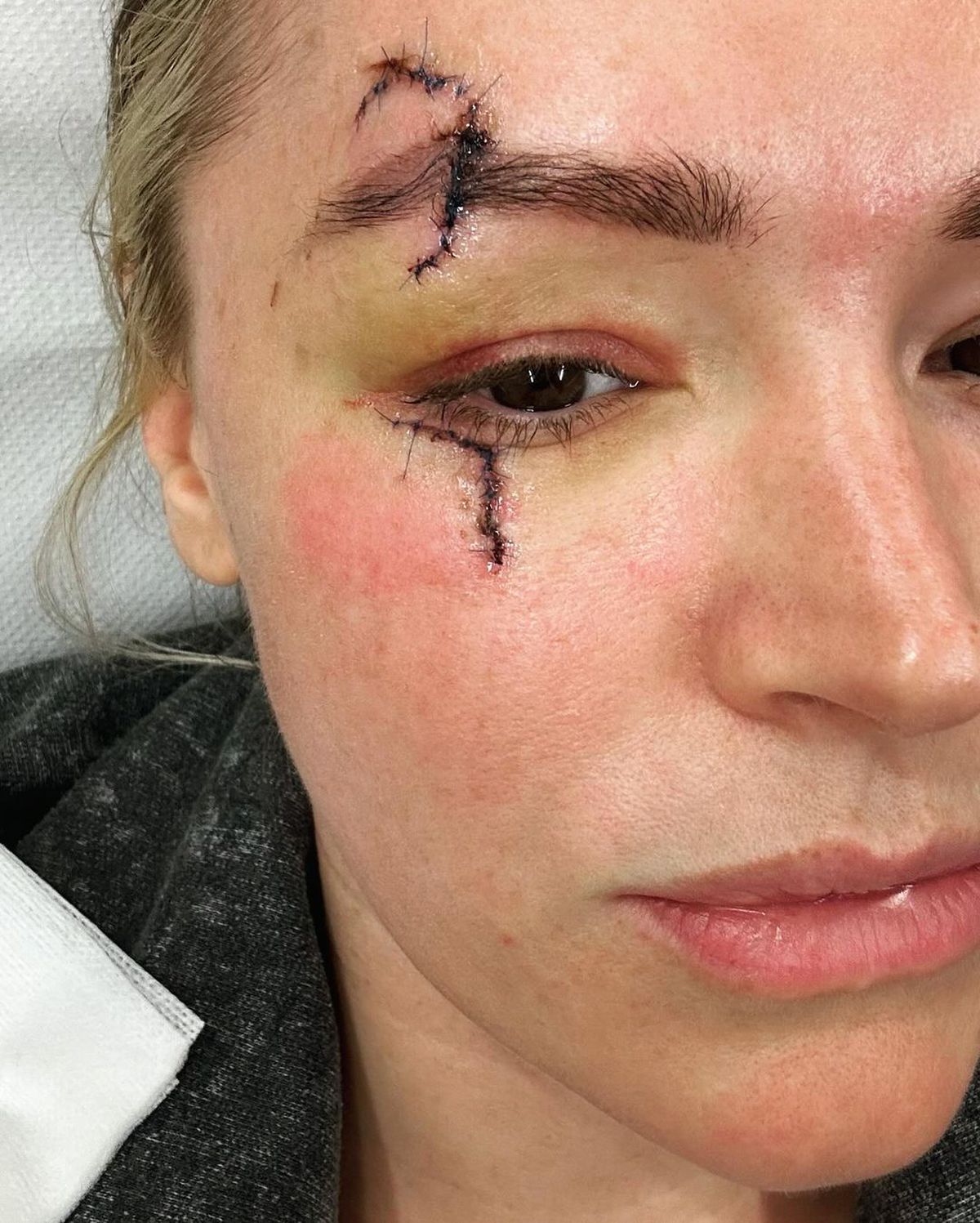 „Catwoman” l-a provocat pe Harry Kane, după Manchester United - Bayern, dar golgeterul Bundesligii a refuzat-o: „Nu vreau să mă fac de râs!”