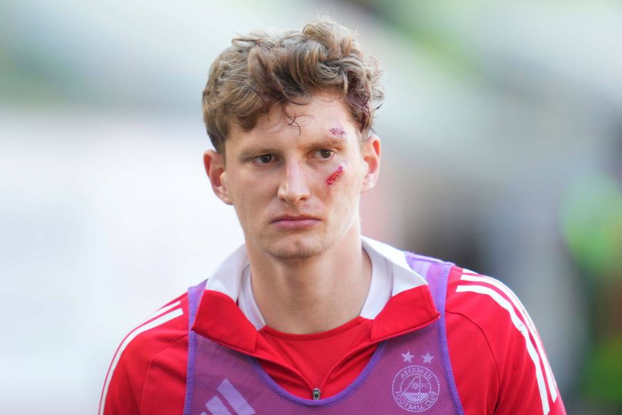 Jack MacKenzie s-a ales că răni deasupra sprâncenei și pe obraz / Foto: Imago Haos la final! Au aruncat un scaun spre propriul jucător, fanii au invadat gazonul!