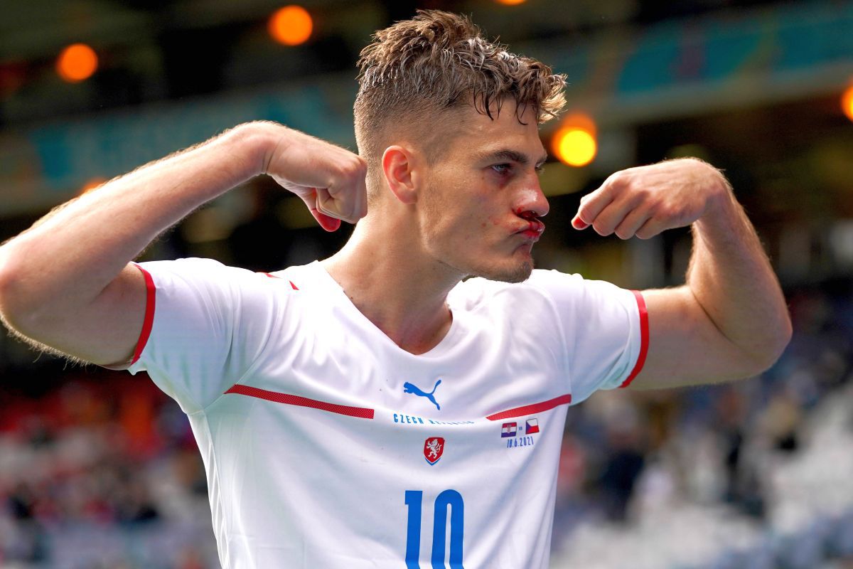 Moment incredibil la Euro 2020 » Eroul Cehiei, plin de sânge la faza golului