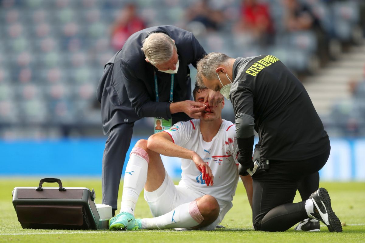 Moment incredibil la Euro 2020 » Eroul Cehiei, plin de sânge la faza golului