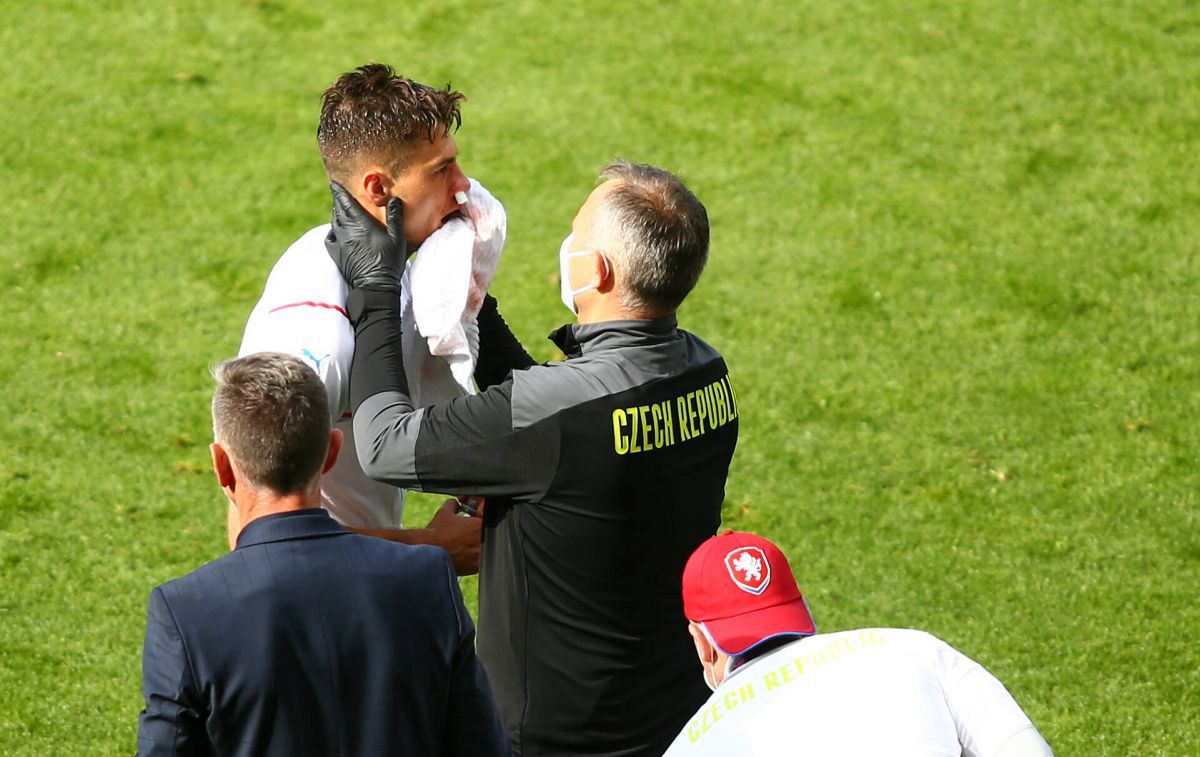 Moment incredibil la Euro 2020 » Eroul Cehiei, plin de sânge la faza golului