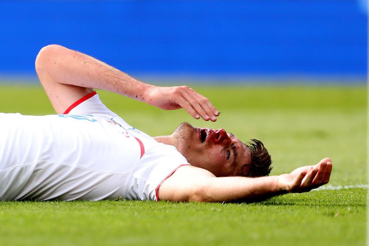 Sânge și sudoare-n iarbă! Năprasnicul Patrik Schick a oferit imaginea zilei la EURO 2020