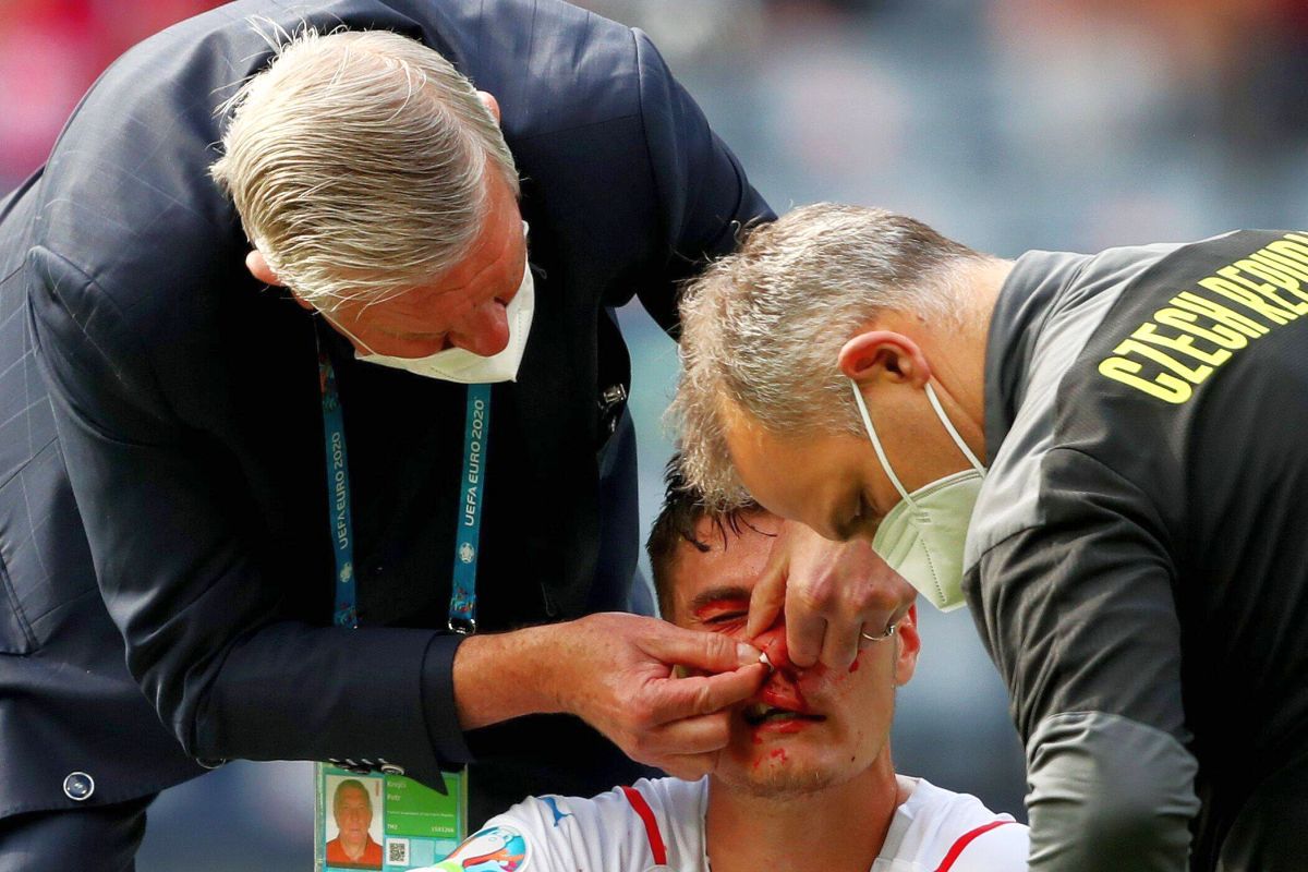 Moment incredibil la Euro 2020 » Eroul Cehiei, plin de sânge la faza golului