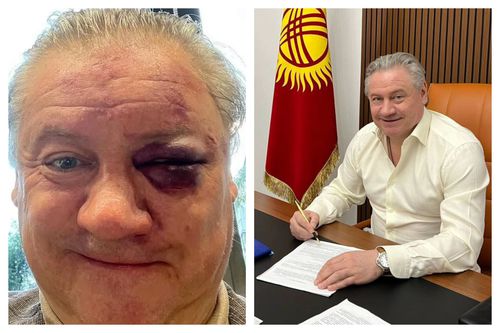 Andrey Kanchelskis, înainte (dreapta) și după (stânga) acel conflict fizic