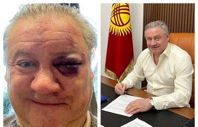 De nerecunoscut! Imagine șocantă: i-a învinețit ochiul dublului campion cu Manchester United