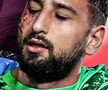 Diagnosticul primit de Gianluigi Donnarumma și o imagine tulburătoare: i-au aplicat de urgență 10 copci!