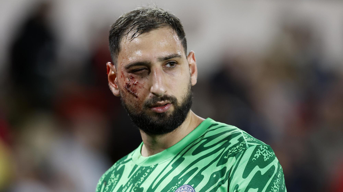 Gianluigi Donnarumma a suferit o accidentare groaznică în meciul AS Monaco - PSG