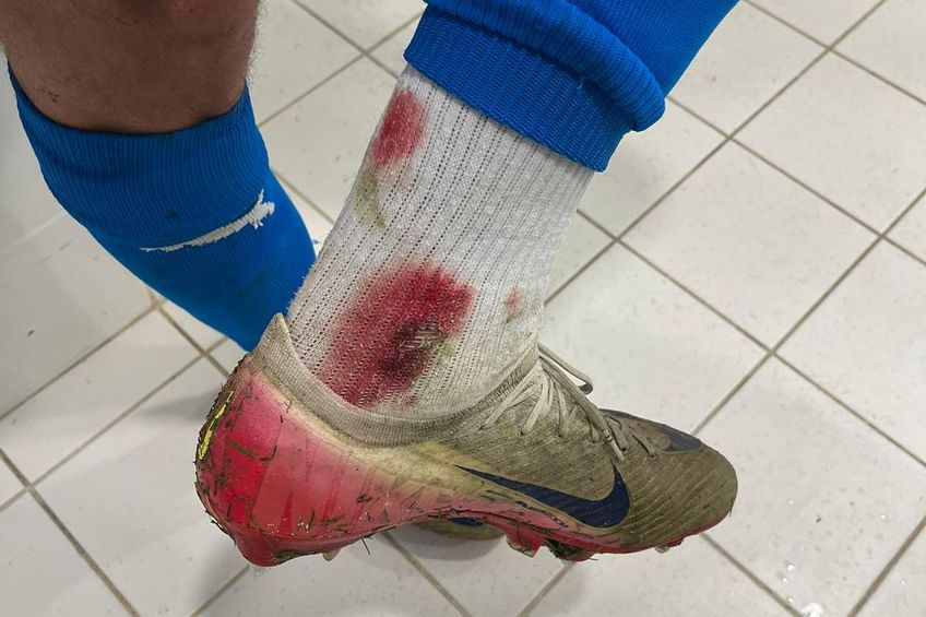 FOTO Oltenii acuză: „Ne așteptam să tragă arbitrul cu ei” » Imagine cruntă din vestiar