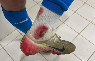 Oltenii acuză: „Ne așteptam să tragă arbitrul cu ei” » Imagine cruntă din vestiar