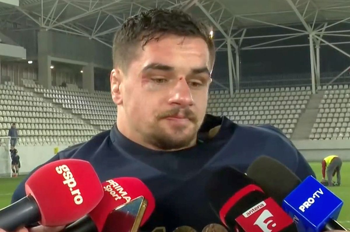 Imagini de impact » Cu ochiul tumefiat și buza spartă, căpitanul României vorbește printre lacrimi și suspine: „Dacă nu se poate cu vorbă bună...”