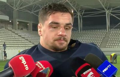 Imagini de impact » Cu ochiul tumefiat și buza spartă, căpitanul României vorbește printre lacrimi și suspine: „Dacă nu se poate cu vorbă bună...”