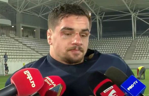 Imagini de impact » Cu ochiul tumefiat și buza spartă, căpitanul României vorbește printre lacrimi și suspine: „Dacă nu se poate cu vorbă bună...”