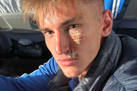 Așa arată Cătălin Itu după intervenția brutală a lui Ghiocel / Sursă foto: Instagram