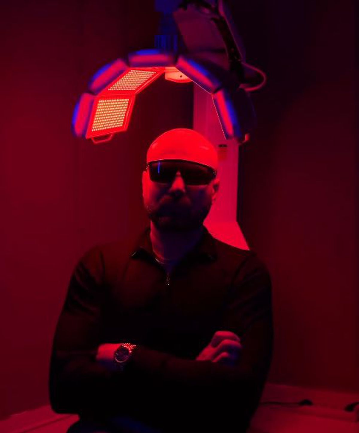 Adrian Mutu și-a făcut implant de păr