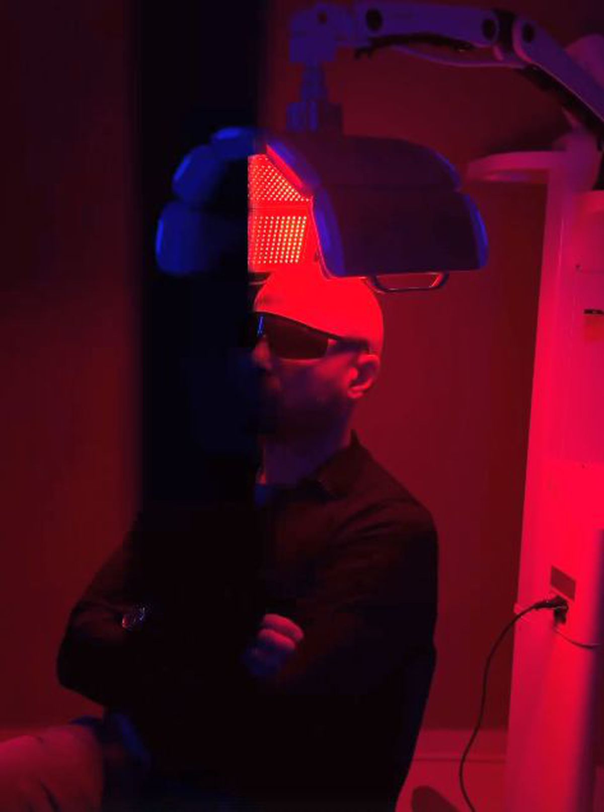 Adrian Mutu și-a făcut implant de păr