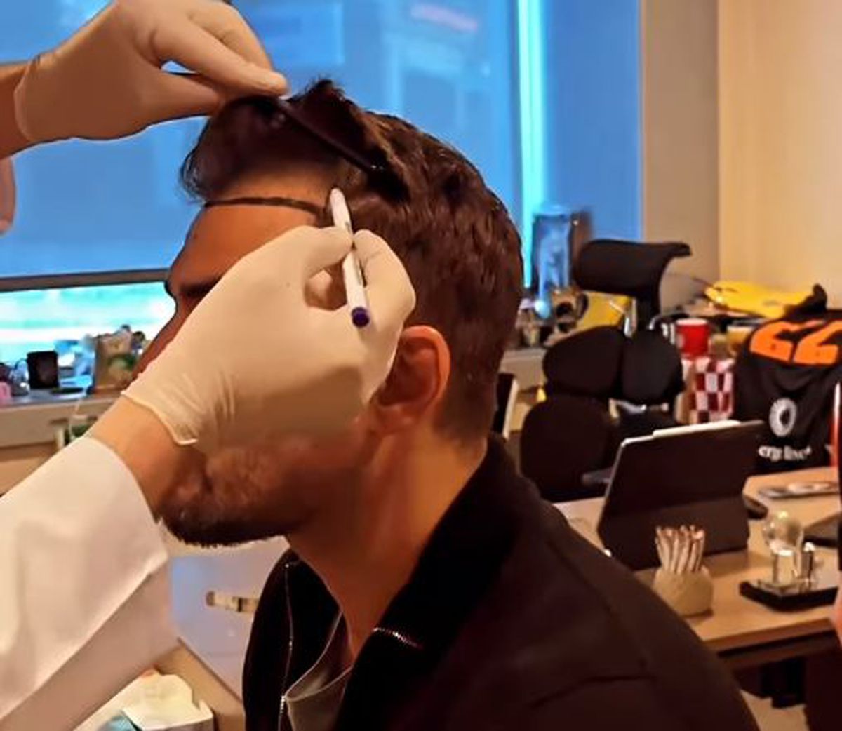 Adrian Mutu și-a făcut implant de păr