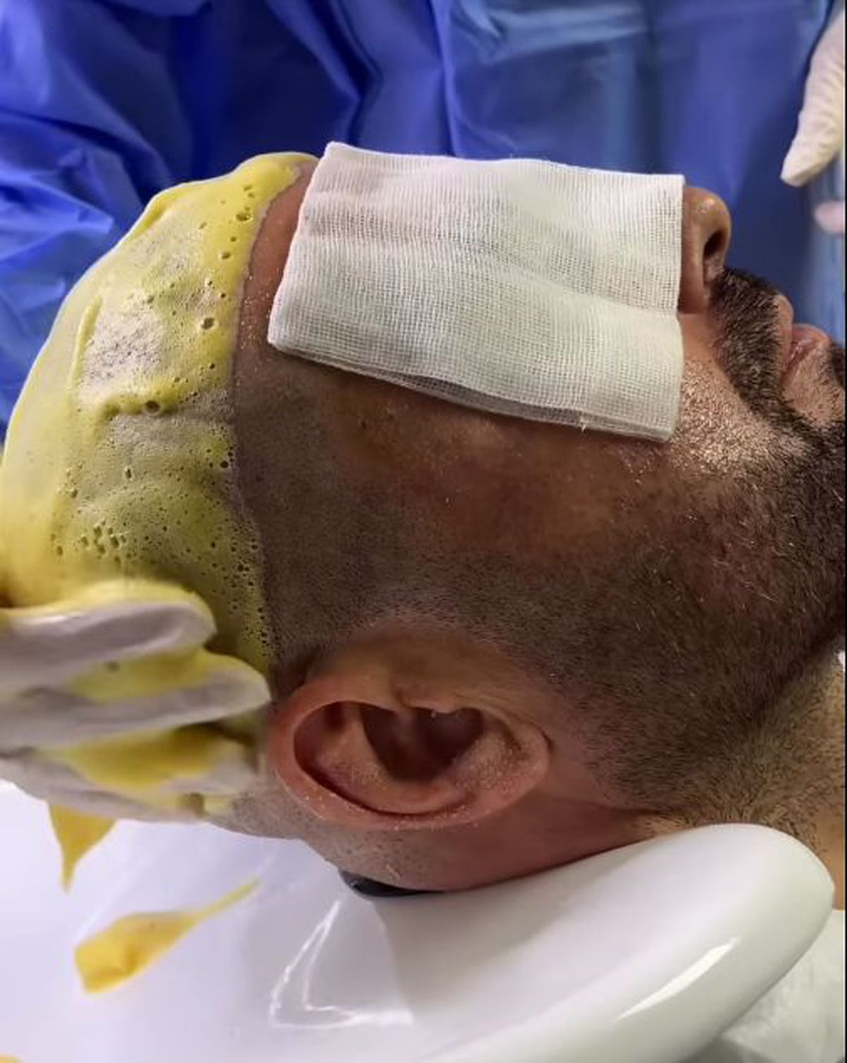 Adrian Mutu, la operație în Turcia: „Zici că-i aveam pe Robert Niță și Messi pe extreme! Nu e dureros”