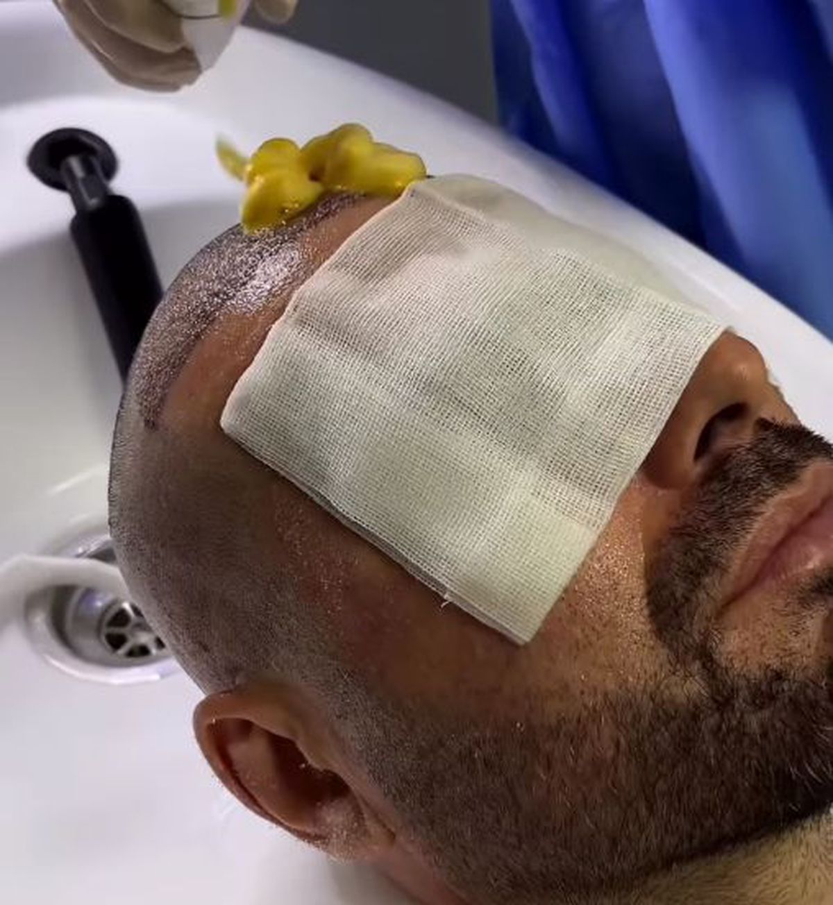 Adrian Mutu, la operație în Turcia: „Zici că-i aveam pe Robert Niță și Messi pe extreme! Nu e dureros”