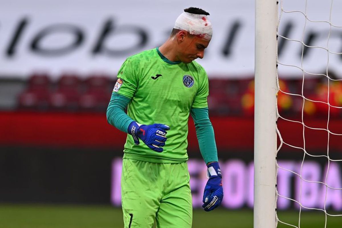 Imagini cu impact emoțional » Cum arată Vâlceanu, după lovitura la cap primită în meciul cu CFR + Cordea și-a pierdut un dinte