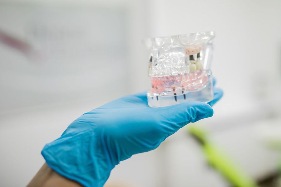 Tratamentele fără durere, o normalitate, nu un lux în cazul implanturilor dentare, în 2022!