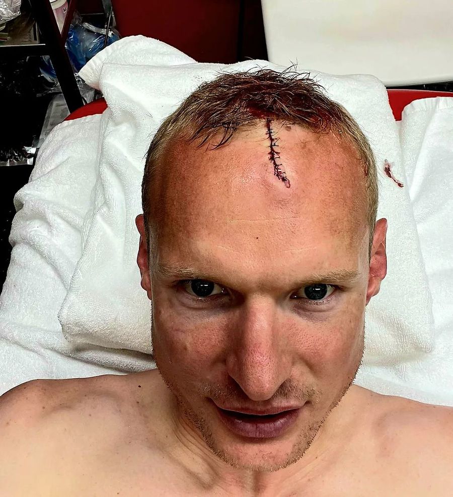 foto: Instagaram @rodesebastian Imaginea horror postată de Rode, după accidentarea din finala Europa League