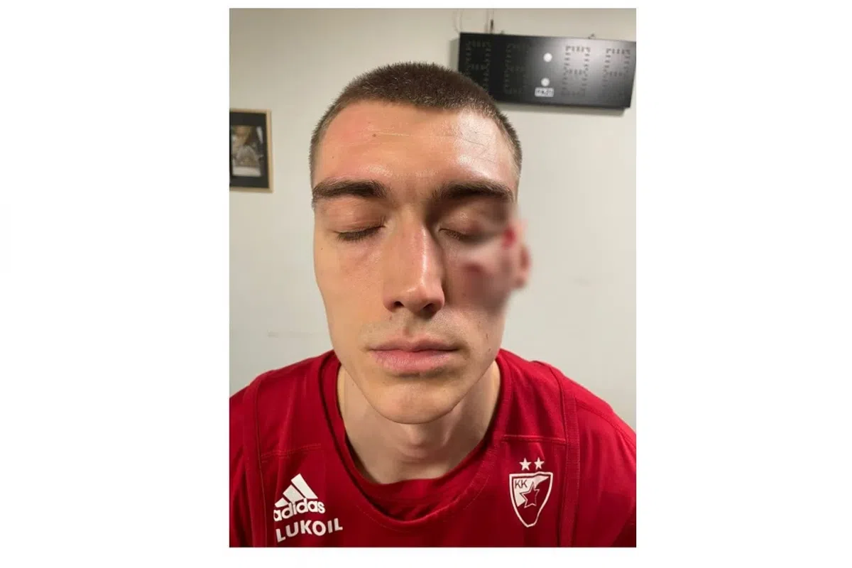 Scene scandaloase înaintea derby-ului de diseară » Jucătorii s-au luat la bătaie la vestiare! Se cere intervenția Ministerului de Interne: „Vătămare corporală gravă!