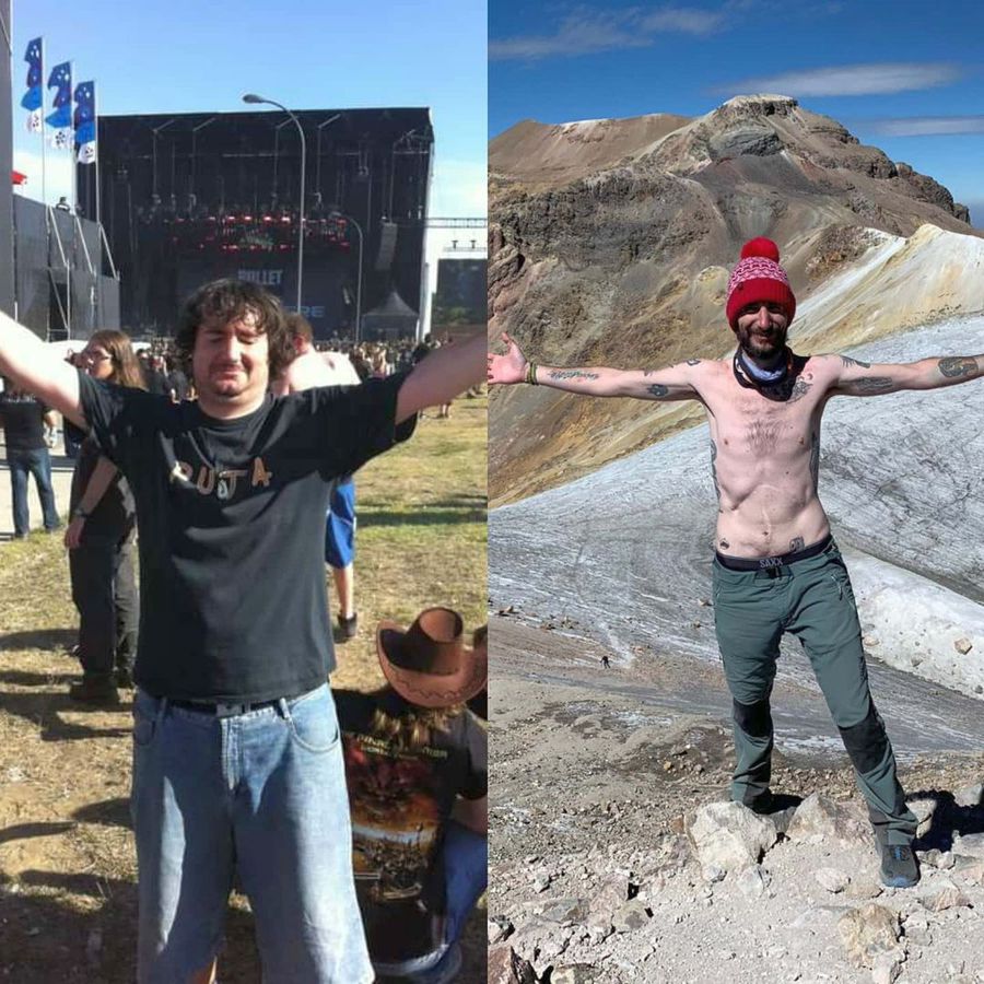 Juan, înainte și după operații (foto: Instagram) Juan, maratonistul fără stomac, vezică și colon. Campioană europeană între ședințele de chimioterapie + Surpriză pentru Diego