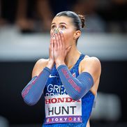 Amy Hunt / FOTO: Imago