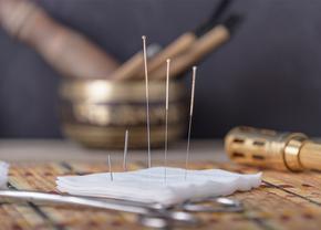 De ce să folosești terapia prin acupunctură pentru diverse afecțiuni ?