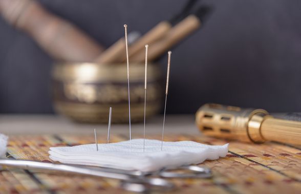 De ce să folosești terapia prin acupunctură pentru diverse afecțiuni ?