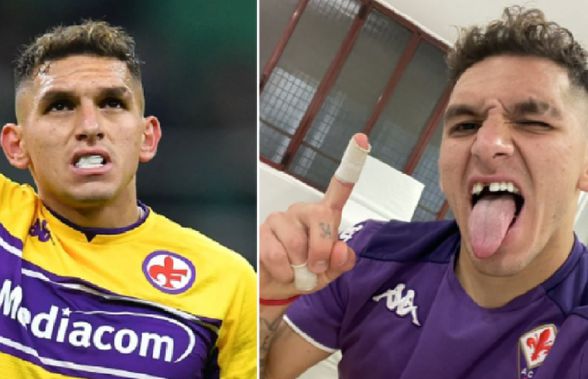 Imaginea zilei în Serie A » Un jucător a rămas știrb după Inter - Fiorentina: „Un punct în plus, un dinte în minus”