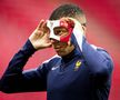 „Zorro” al Franței » Kylian Mbappe va purta o mască specială la Euro, după ce și-a spart nasul