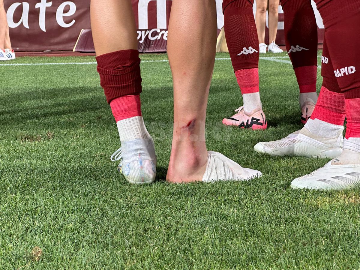 Medicii au anunțat verdictul în cazul lui Albion Rrahmani, ieșit în lacrimi de pe teren în Rapid - CFR Cluj