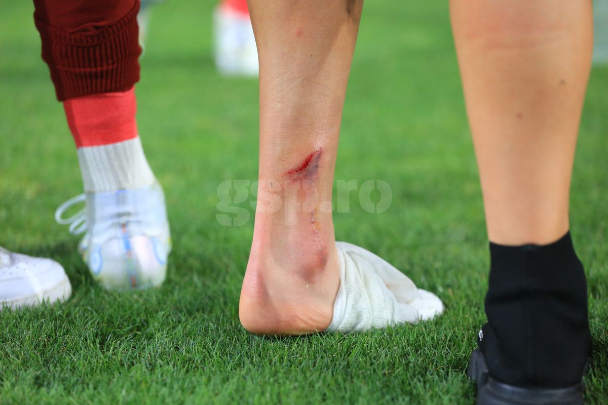 Albion Rrahmani a ieșit accidentat de pe teren