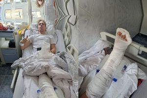 Accidentat grav de adversarul care a jucat pe fals, Denis Baciu a vorbit cu GSP după operație: „Mi-am pus glezna la loc, acolo, pe teren, dar atârna susținută doar de piele" » Ce șanse îi dau doctorii să mai poată juca