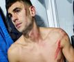 Igor Armaș nu uită și nu iartă: „Edjouma trebuia eliminat, chiar și după meci! N-am nevoie de scuzele lui”