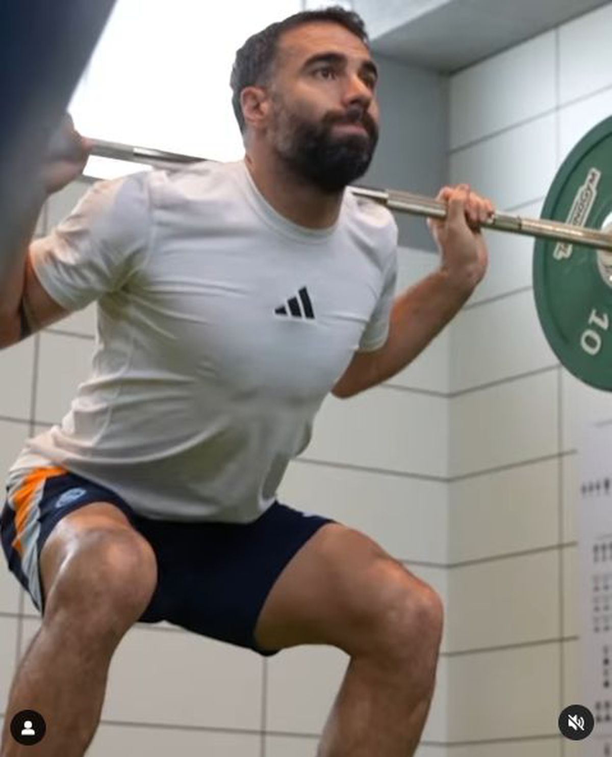 Piciorul lui Dani Carvajal după operație