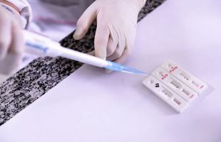 CORONAVIRUS. Epidemiologul Molnar Geza despre pandemia din România: „Fără discuție, asta e data la care trebuie ridicată carantină”