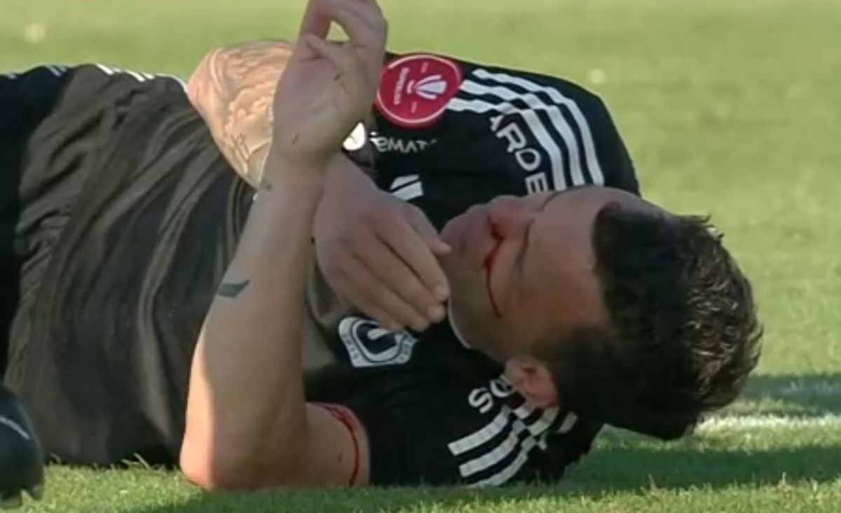 Dan Nistor, plin de sânge la Galați » Imagini dure cu jucătorul lui U Cluj transportat la spital