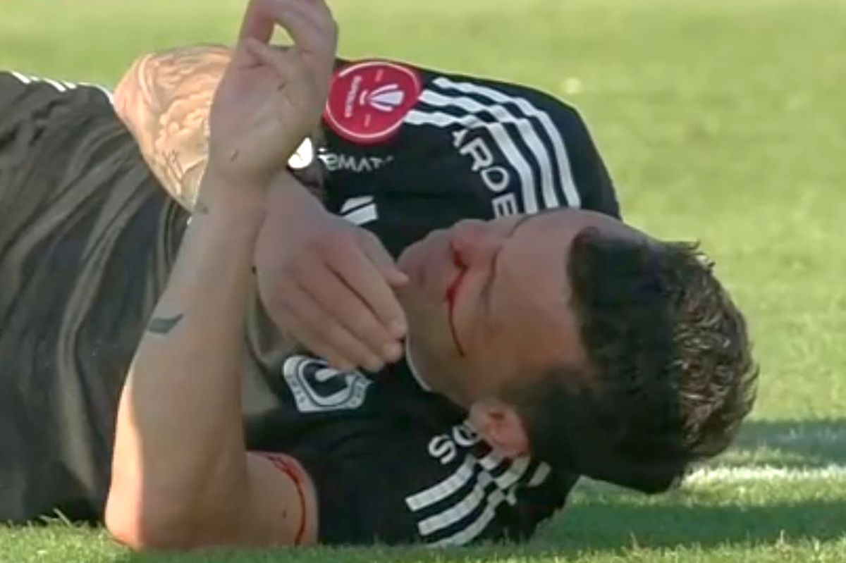 Dan Nistor, plin de sânge la Galați » Imagini dure cu jucătorul lui U Cluj transportat la spital