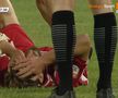 AUCH! Ciocnire horror în U Cluj - Dinamo: fotbalistul lui Uhrin, schimbat după ce a fost făcut K.O. de Ely Fernandes!