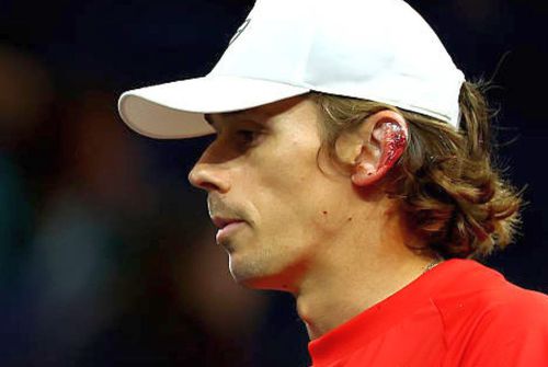Urechea însângerată a lui Alex De Minaur / Foto: puntodebreak.com