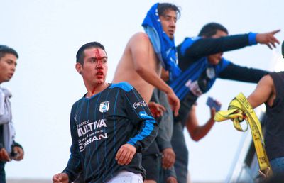 VIDEO Imagini de o violență nemaivăzută » 37 de fani grav răniți în prima ligă din Mexic: „Nu am mai văzut așa ceva în fotbal”