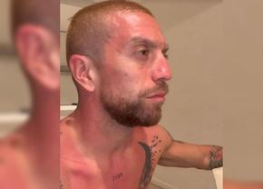 „Am nevoie de aloe vera” » Sărbătoarea de titlu a Argentinei l-a lăsat cu urme pe Papu Gomez