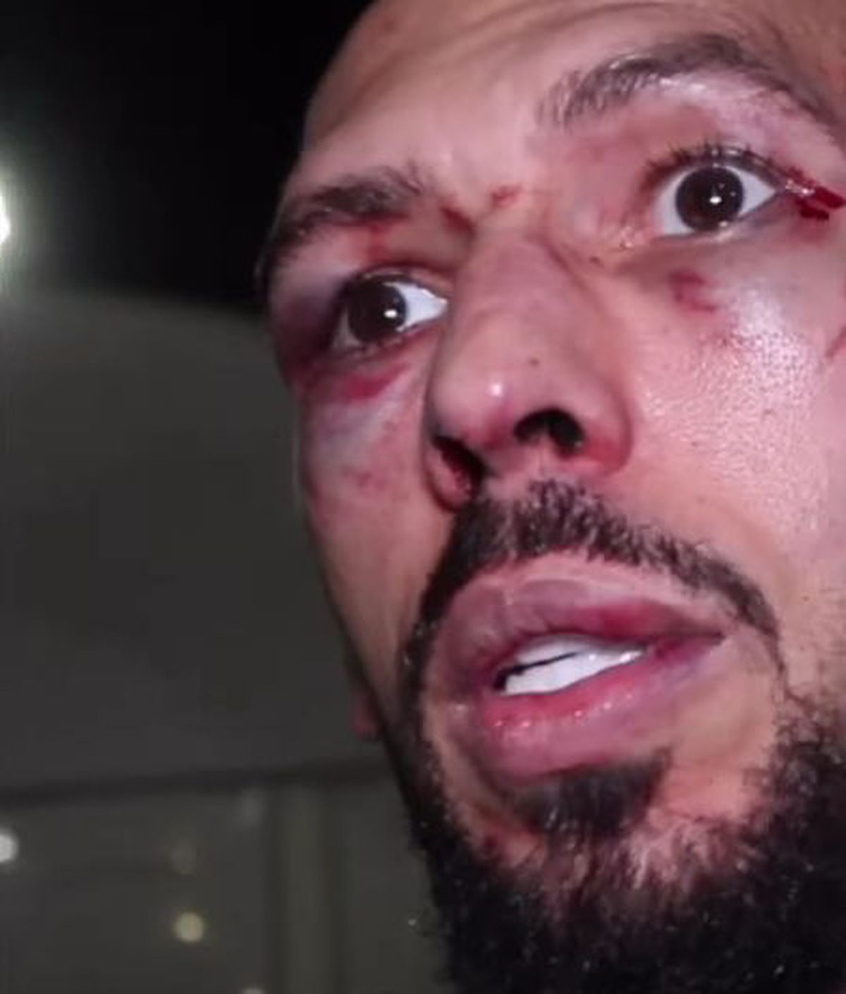 După 5 ani, Andrew Tate a revenit în ring! Un actor l-a umplut de sânge: „Trebuia să-mi înfrunt frica”